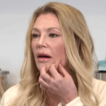 Brandi Glanville revela queimaduras dolorosas